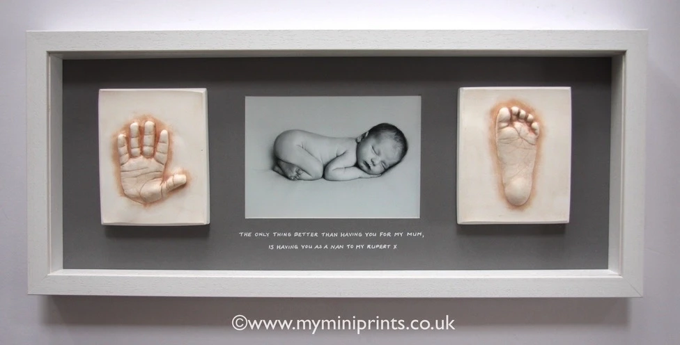 Hand & foot cast on granite backing